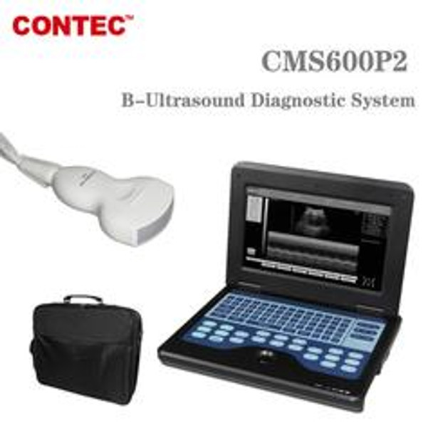 Portable Laptop Machine Digital Ultrasound Scanner